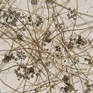 Proben oder Partikel analysieren